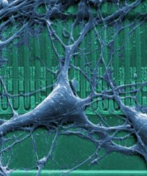 Neuronal Network on Microchips